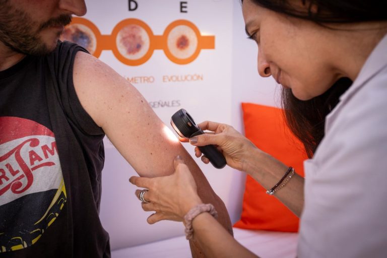 Quilmes salió a la plaza a testear VIH y controlar lunares: 101 personas se hicieron el test en el primer día